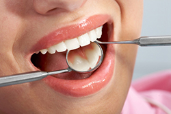 Young woman sitting in a dental chair and smiling while getting a dental exam and dental cleaning at Arlington Pediatric Dentistry in Arlington, WA