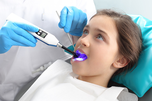 Image of a child getting dental sealants at Arlington Pediatric Dentistry in Arlington, WA.